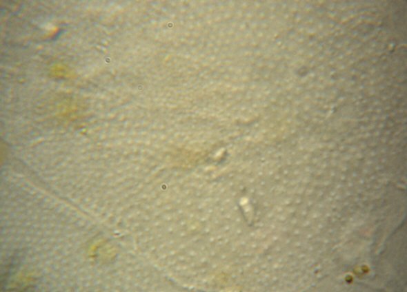 [ Baltic Sea tardigrade, cuticula ]