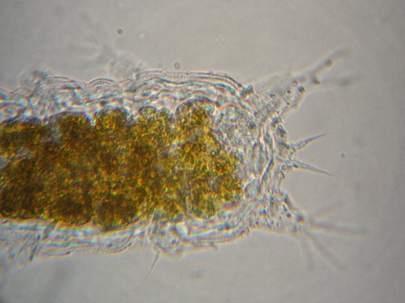 [ Baltic Sea tardigrade, hind body ]