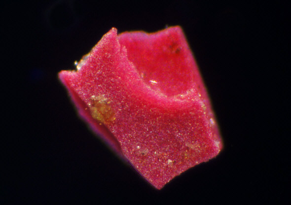 [ Kunststoffpartikel aus dem M&uuml;nchner Pflasterritzenmoos ]