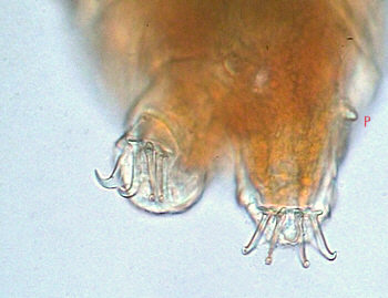 [tardigrades cornechiniscus cornutus]