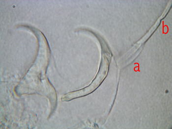 [ Tardigrada, tardigrades: Ramazzottius ]