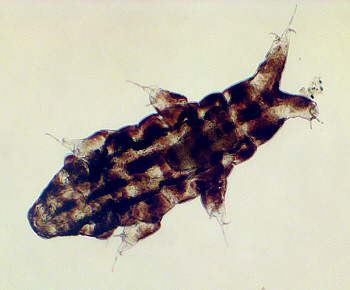 [ Tardigrada, tardigrades: Ramazzottius sp. ]