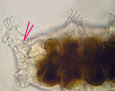 [ Echiniscoides sigismundi ]