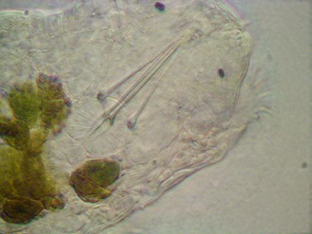 [ Echiniscoides sigismundi ]