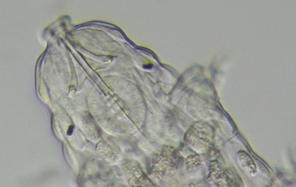 [ Mittelgro&szlig;er Eutardigrade von der &ouml;sterreichischen Felswand ]