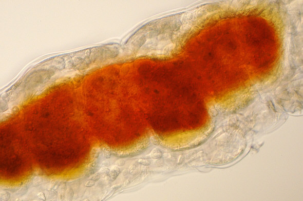 [ Typical tardigrade as found in Munich city pavement moss. Detail, red stomach-intestine region ]