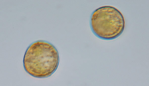 [ Spores of Grimmia pulvinata ]