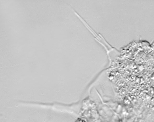 [ Halechiniscus sp. Cuticula: Detail mit Cirrus ]