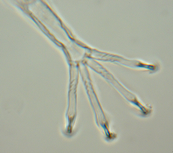 [ Halechiniscus sp. Cuticula: Detailaufnahme eines Fu&szlig;es bei hoher Vergrl&ouml;&szlig;erung ]