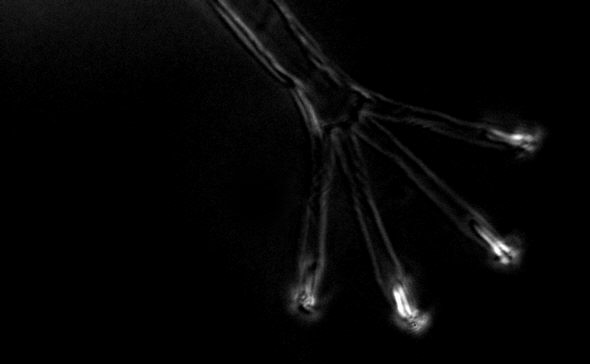[ Halechiniscus sp. Cuticula: Detailaufnahme eines Fu&szlig;es im polarisierten Licht ]