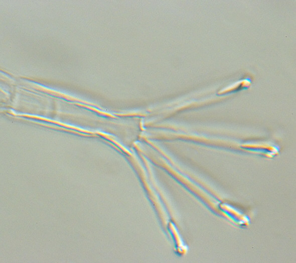 [ Halechiniscus sp. Cuticula: Detailaufnahme eines Fu&szlig;es ]