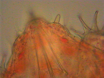 [ tardigrades, tardigrade, water bear, Echiniscus sp.]