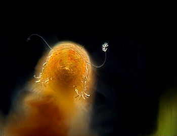 [ Tardigrada, B&auml;rtierchen; CombineZ ]