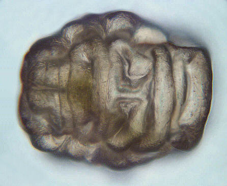 [ Tardigrada, B&auml;rtierchen; "T&ouml;nnchen"]