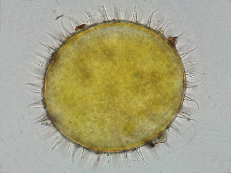 [ yellow tardigrade from the Bavarian Alps ]