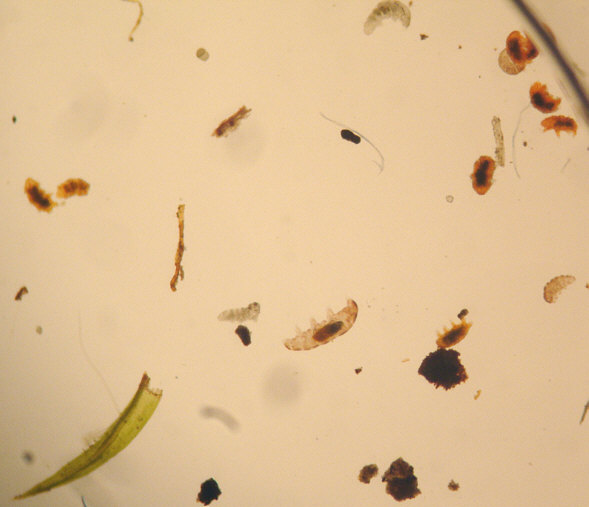 [ Einfaches Stereomikroskop: Demobild B&auml;rtierchen ]