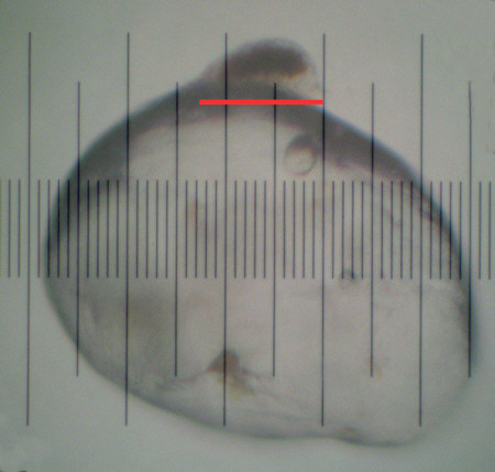 [ Batillipes tardigrade from the Kiel Foehrde ]