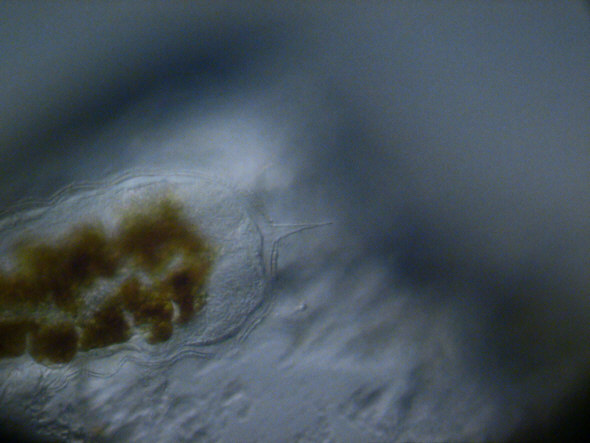 [ Batillipes tardigrade from the Kiel Foehrde ]