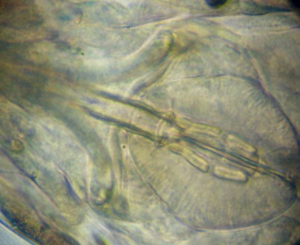 [ Macrobiotus hufelandi (sensu lato) ]