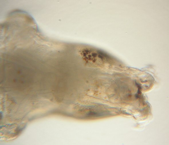 [  Macrobiotus hufelandi (sensu lato), Pigmentierung ]