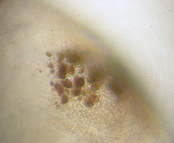 [ Macrobiotus hufelandi (sensu lato), Pigmentierung ]