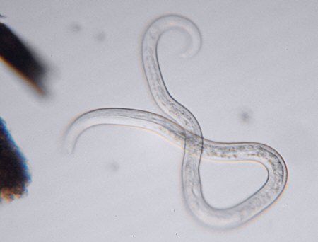 [ The same nematode at higher magnification ]