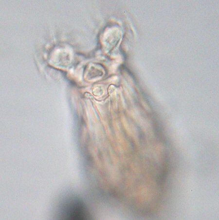 [ Rotifer at higher magnification ]