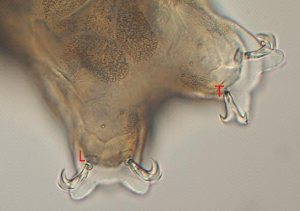 [ A tardigrade from Munich pavement moss: anatomical detail ]