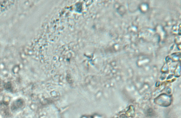 [ Halechiniscus Cuticula von der kroatischen Insel Krapanj: Totale ]