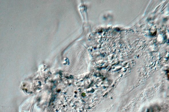 [ Halechiniscus Cuticula von der kroatischen Insel Krapanj: Totale ]
