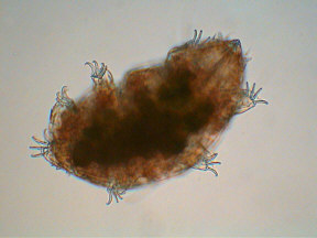 tardigrades
