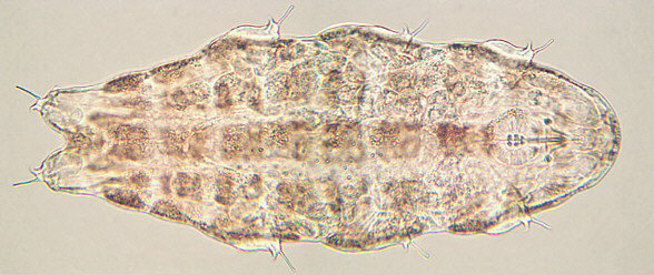 tardigrades