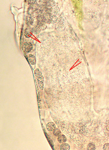 [ tardigrade male: the gonads ]