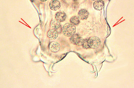 [ tardigrade male: the hind legs ]