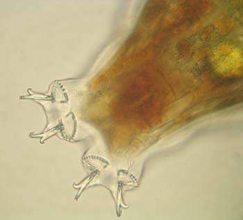 Tardigrades-A10