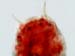 Tardigrades-A18